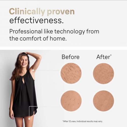 Braun Gift Box: PL5347 Beauty Set, Body Trimmer BS100 & Venus Skin Smooth Exfoliant